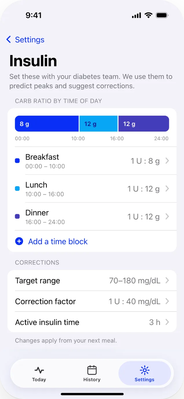 Insulin settings: a strip showing the day’s carb ratios by time of day, with corrections settings below.